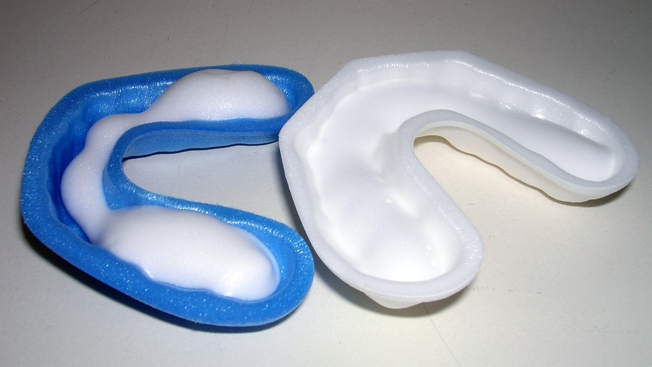 Fluoride Application and Dental Sealant