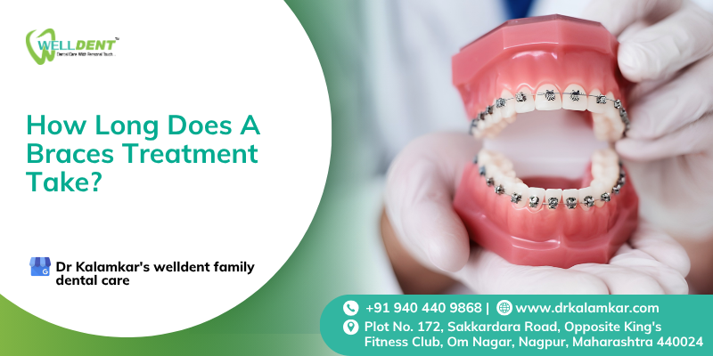 braces treatment near me