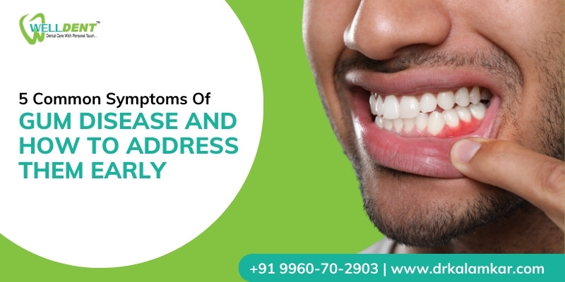 5 Common Symptoms of Gum Disease