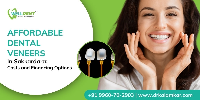 Affordable Dental Veneers In Sakkardara: Costs And Financing Options