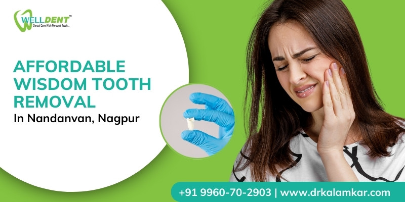 Affordable Wisdom Tooth Removal in Nandanvan, Nagpur