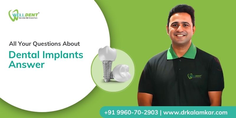 All Your Questions About Dental Implants Answered