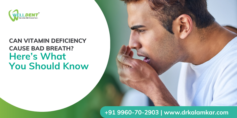 bad breath treatment in Nandanvan