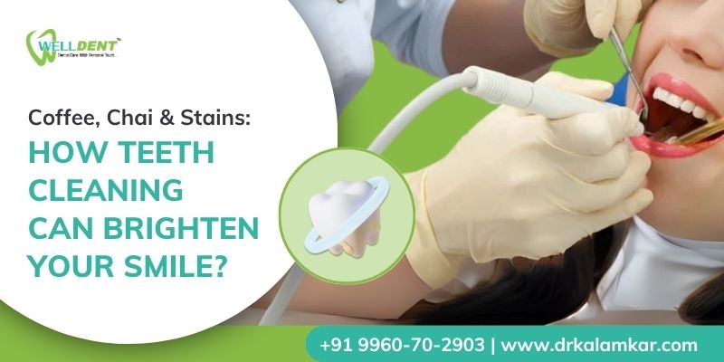 Coffee, Chai & Stains: How Teeth Cleaning Can Brighten Your Smile