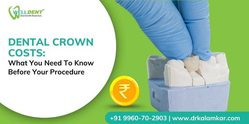 Dental Crown Costs: What You Need to Know Before Your Procedure