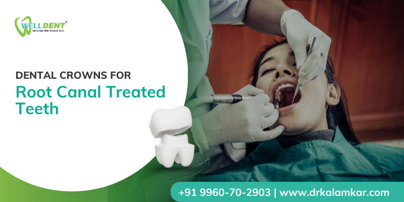 dental Crown Cost in Nandanvan
