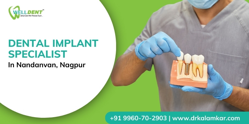 Dental Implant Specialist in Nandanvan, Nagpur