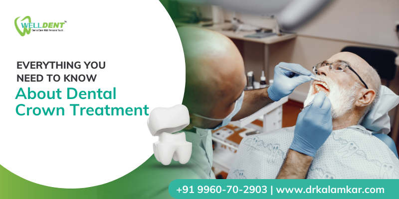 dental crown cost in Sakkardara