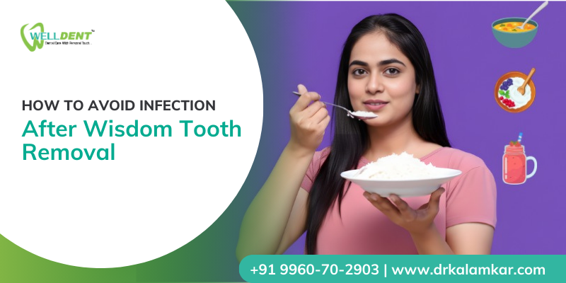 wisdom Tooth Removal in Sakkardara
