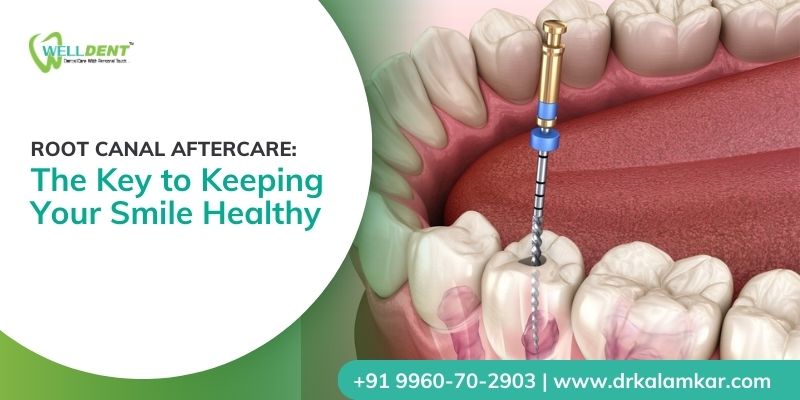 root canal treatment cost in sakkardara