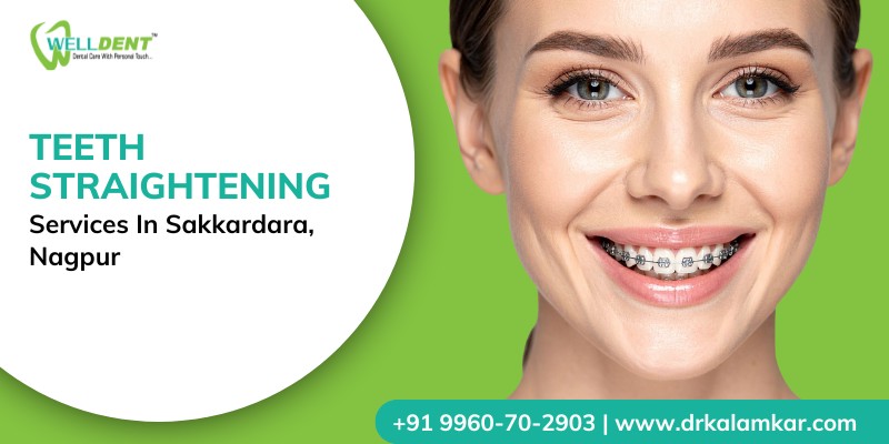 Teeth Straightening Services in Sakkardara, Nagpur