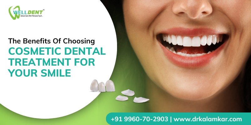 The Benefits of Choosing Cosmetic Dental Treatment for Your Smile