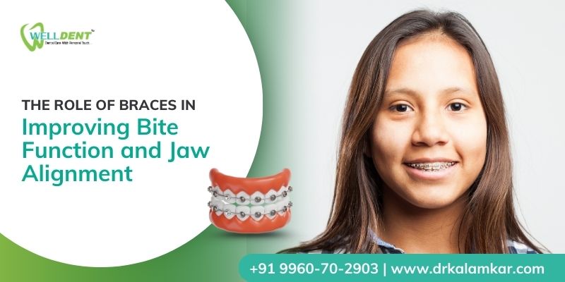 braces treatment in Sakkardara