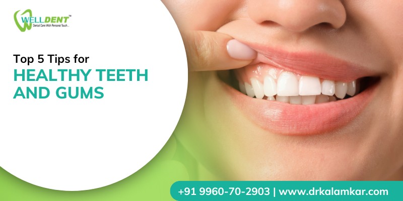 Top 5 Tips for Healthy Teeth and Gums