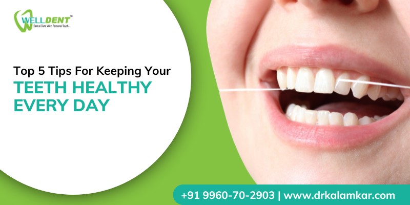 Top 5 Tips for Keeping Your Teeth Healthy Every Day