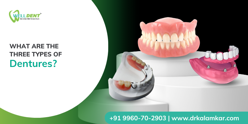What Are the Three Types of Dentures?