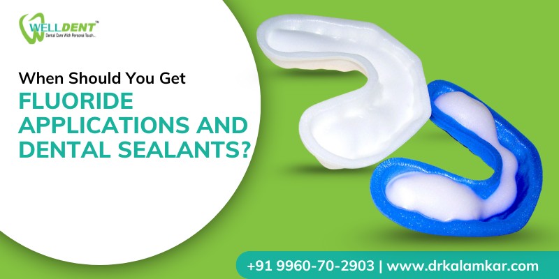 When Should You Get Fluoride Applications and Dental Sealants?
