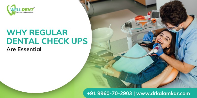 Why Regular Dental Check Ups Are Essential